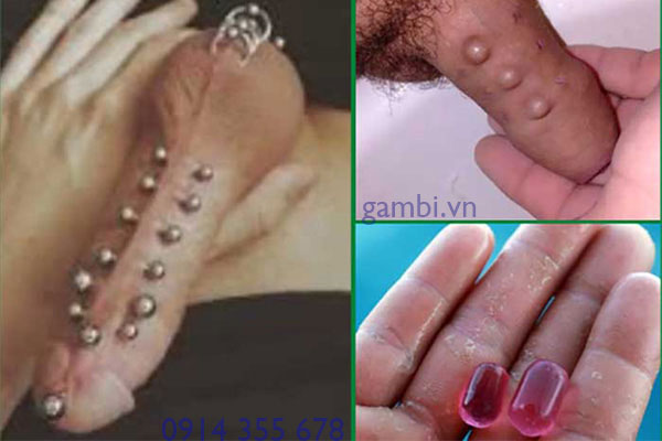 Găm bi dương vật Hải Phòng